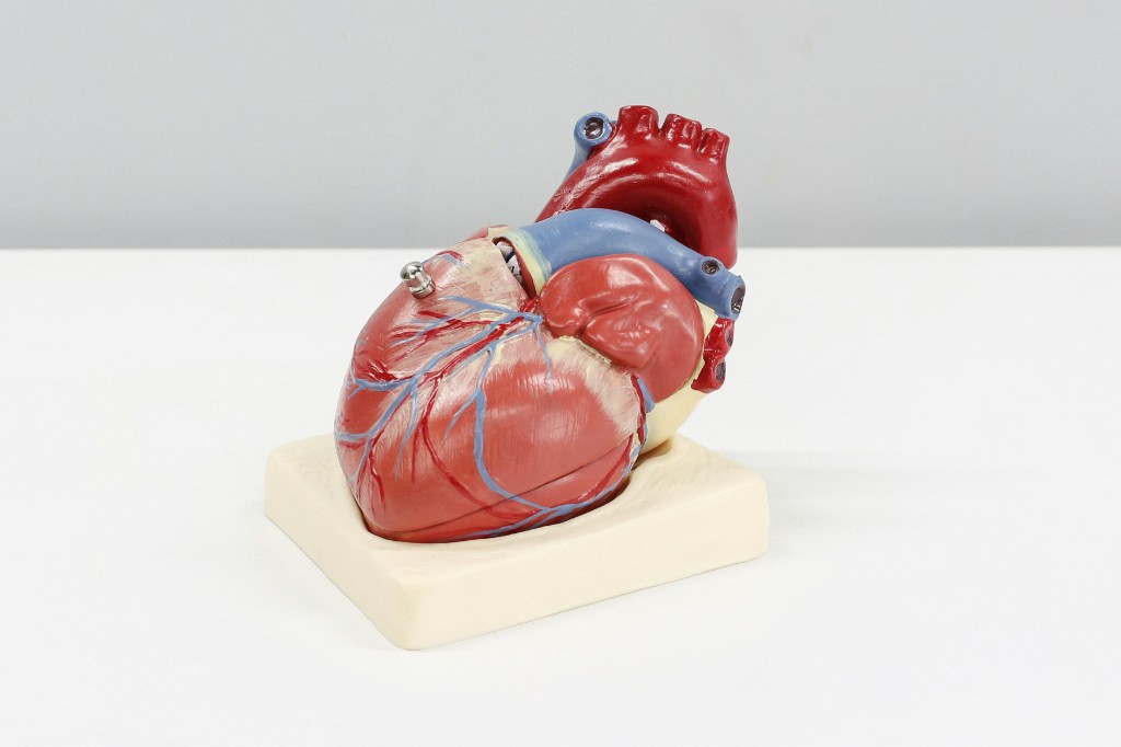 Anatomical model of a human heart